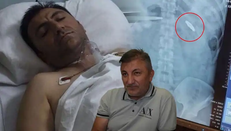 15 Temmuz’un Ardından: 9 Yıldır Vücudundaki Kurşunla Yaşayan Kahraman